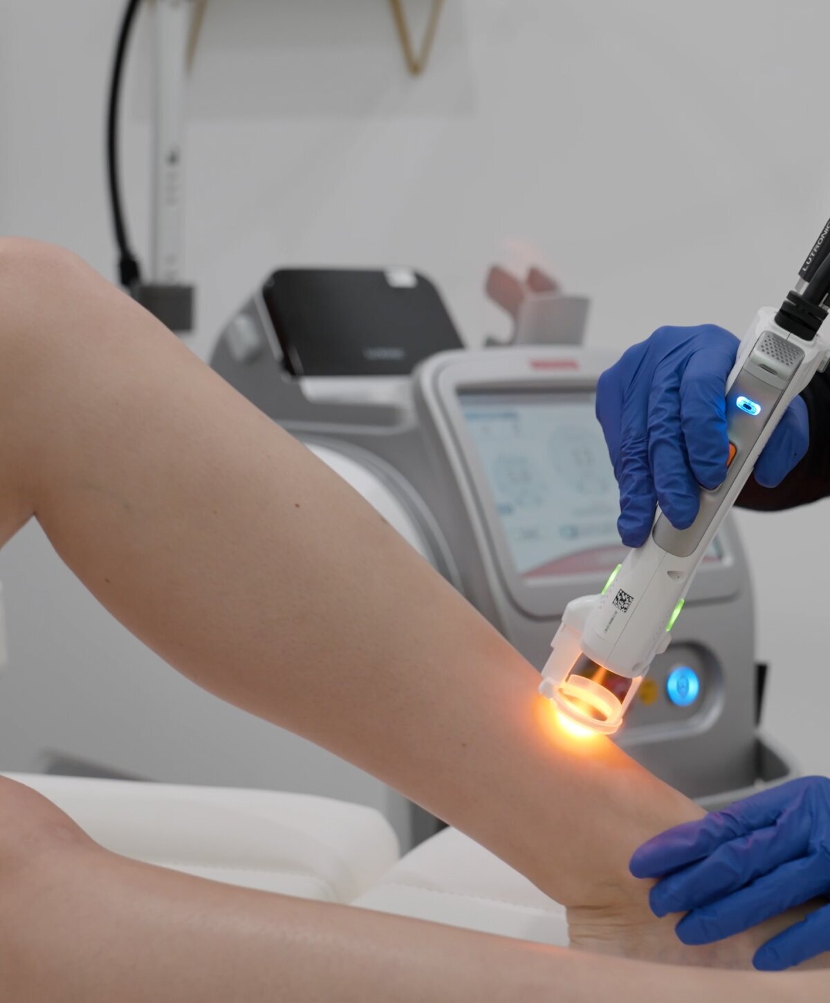 Laser Hair Removal Jupiter Jupiter Hair Removal TruWellnessMD